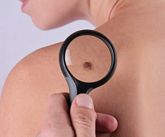 Canadian Dermatology Association